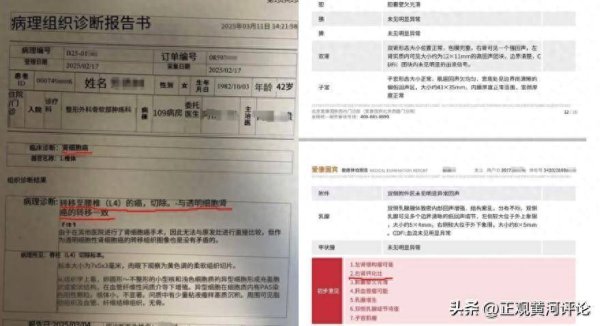 逸富盈策略 评论1+1：女子体检10年未查出癌症，“健康守门人”的失职谁来担责？